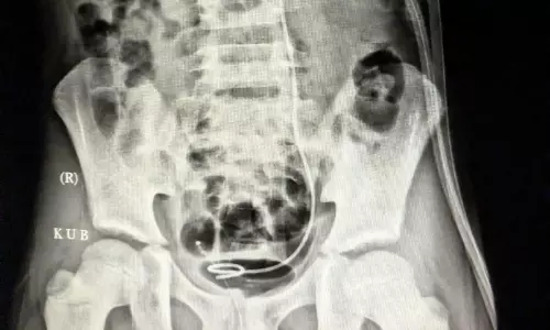 Rising Kidney Stone Incidences in Kids Caused by Poor Water Intake