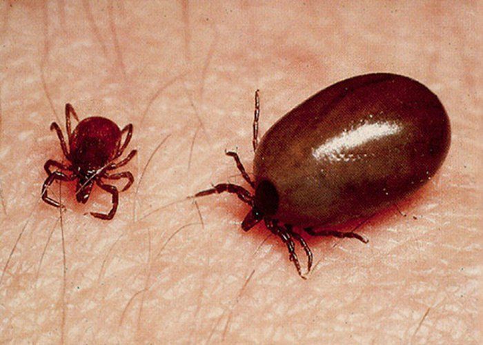 Scrub Typhus Cases Rise in Andhra Pradesh