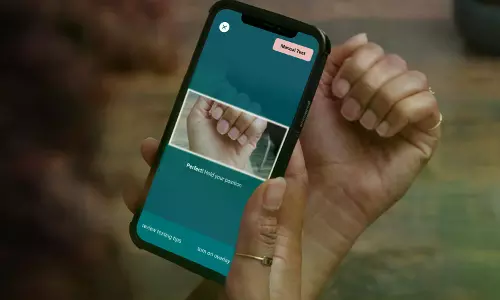 Mobile Apps Can Detect Anaemia, Nutrition Risks