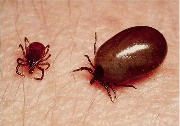 2 More Women Die of Scrub Typhus in AP 2 More Women Die of Scrub Typhus in AP