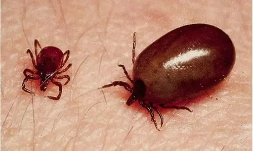 2 More Women Die of Scrub Typhus in AP