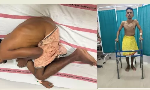 Odisha Man With Severe Spine, Hip Fusion Now Able to Stand and Walk After Complex AIIMS Surgeries