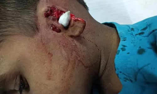 Stray Dog Attack Leaves Five-Year-Old Boy Seriously Injured In Kadiri Stray Dog Attack Leaves Five-Year-Old Boy Seriously Injured In Kadiri