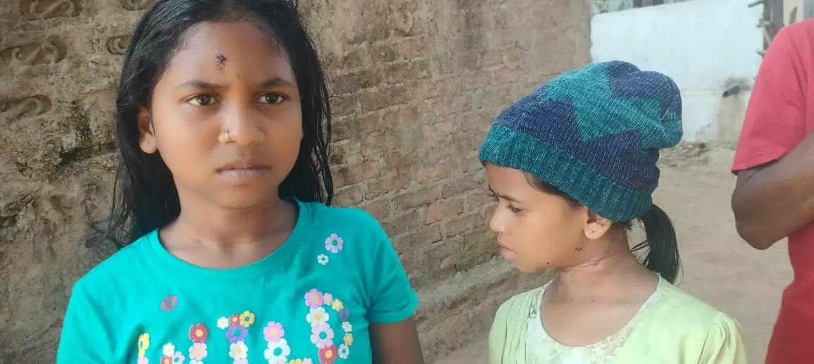 Monkeys Injure Welfare Hostel Girls in Anakapalli District Monkeys Injure Welfare Hostel Girls in Anakapalli District