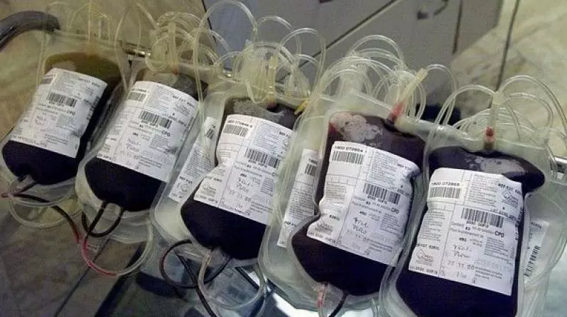 Five Thalassemia Patients Contract HIV After Blood Transfusions In MP Five Thalassemia Patients Contract HIV After Blood Transfusions In MP
