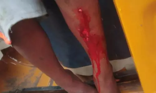 Kid Hospitalised with Dogbite Wounds
