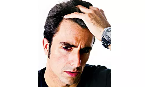 Gen-Z’s Balding Nightmare