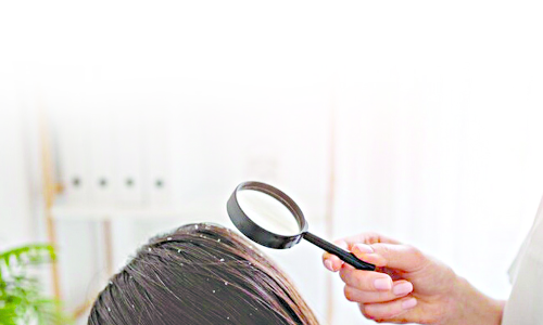 Be Headstrong, Don’t Flake Out Be Headstrong, Don’t Flake Out