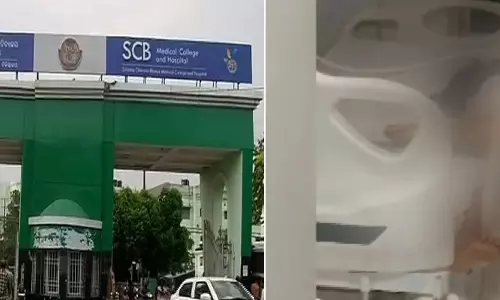 Odisha: ICU Safety Concerns Raised After Viral Video From SCB Medical College In Cuttack Odisha: ICU Safety Concerns Raised After Viral Video From SCB Medical College In Cuttack