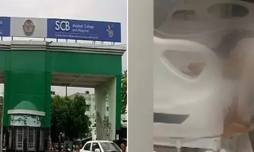 Six-Member Panel To Probe ICU Fall Incident At SCB Medical College Six-Member Panel To Probe ICU Fall Incident At SCB Medical College