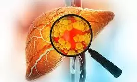 Chandrakant Lahariya | The Adulteration Of Food Is A Silent Assault On Health, Safety of Indians