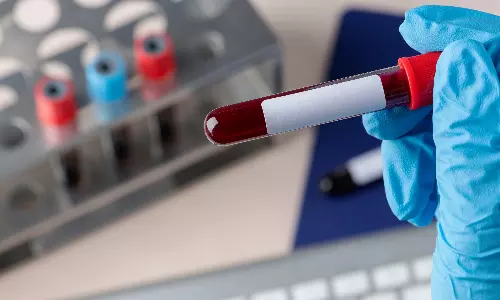 AIIMS Gorakhpur Doctors Find Rare “Bombay” Blood Group in Pregnant Woman