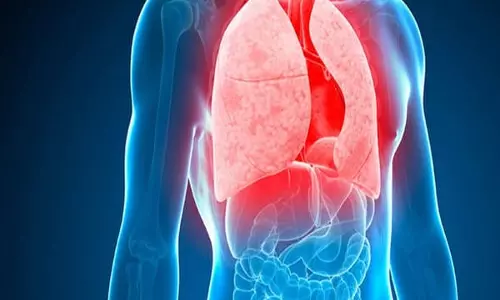 Districts Seek More Radiographers for TB Drive