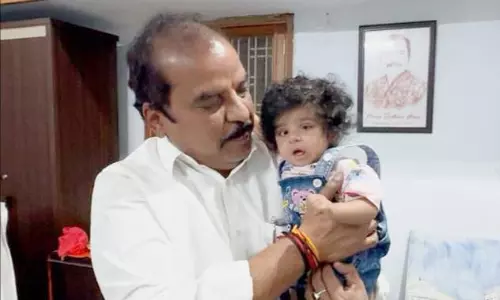 Six-month-Old Girl Undergoes Heart Surgery In Hyderabad Six-month-Old Girl Undergoes Heart Surgery In Hyderabad