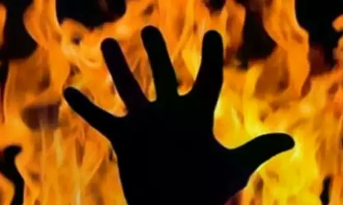 MP/ Class Nine Girl Student Set Herself On Fire After Being Harassed By Minor Boy, Battling With Her Life In Hospital