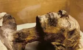 Aged Women With Memory Decline Stays With Decomposed Body Of Her Husband For About A Week