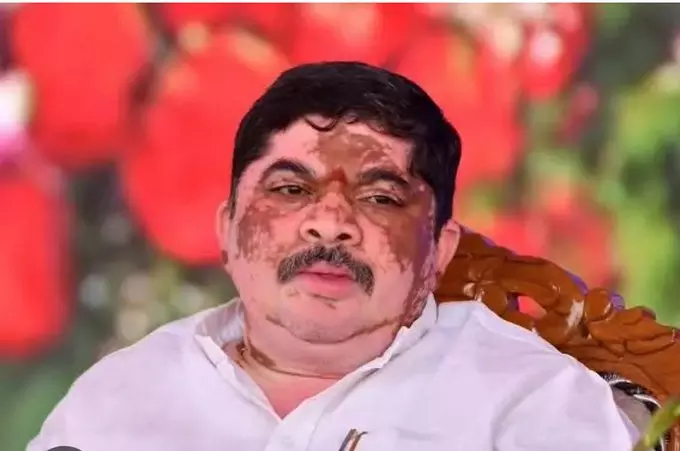 Ponnam Denies Vendetta Politics against Bandi Sanjay’s Son Ponnam Denies Vendetta Politics against Bandi Sanjay’s Son