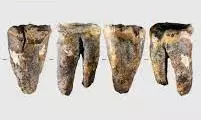Tooth From Siberian Cave Reveals Neanderthal Dental Surgery