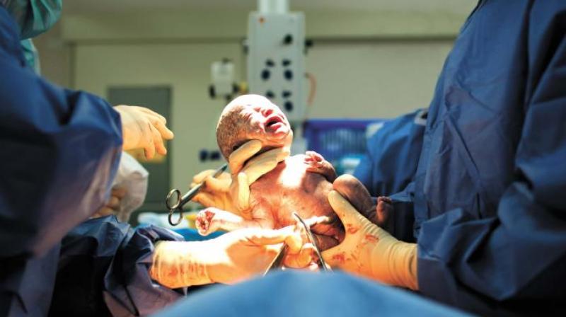 Fertility Rate Slight Increase, Caesarean Births Rise In Telangana: NFHS-6