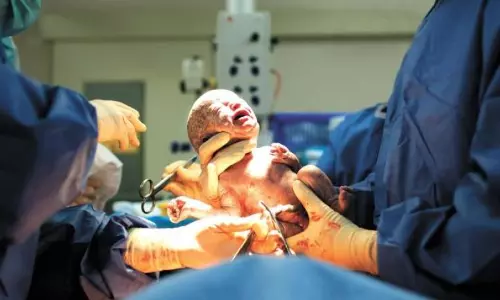 Fertility Rate Slight Increase, Caesarean Births Rise In Telangana: NFHS-6 Fertility Rate Slight Increase, Caesarean Births Rise In Telangana: NFHS-6
