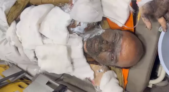 VSP Blast: Injured Workers Emotional Message To Family Moves Heart VSP Blast: Injured Workers Emotional Message To Family Moves Heart