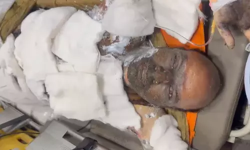 VSP Blast: Injured Workers Emotional Message To Family Moves Heart