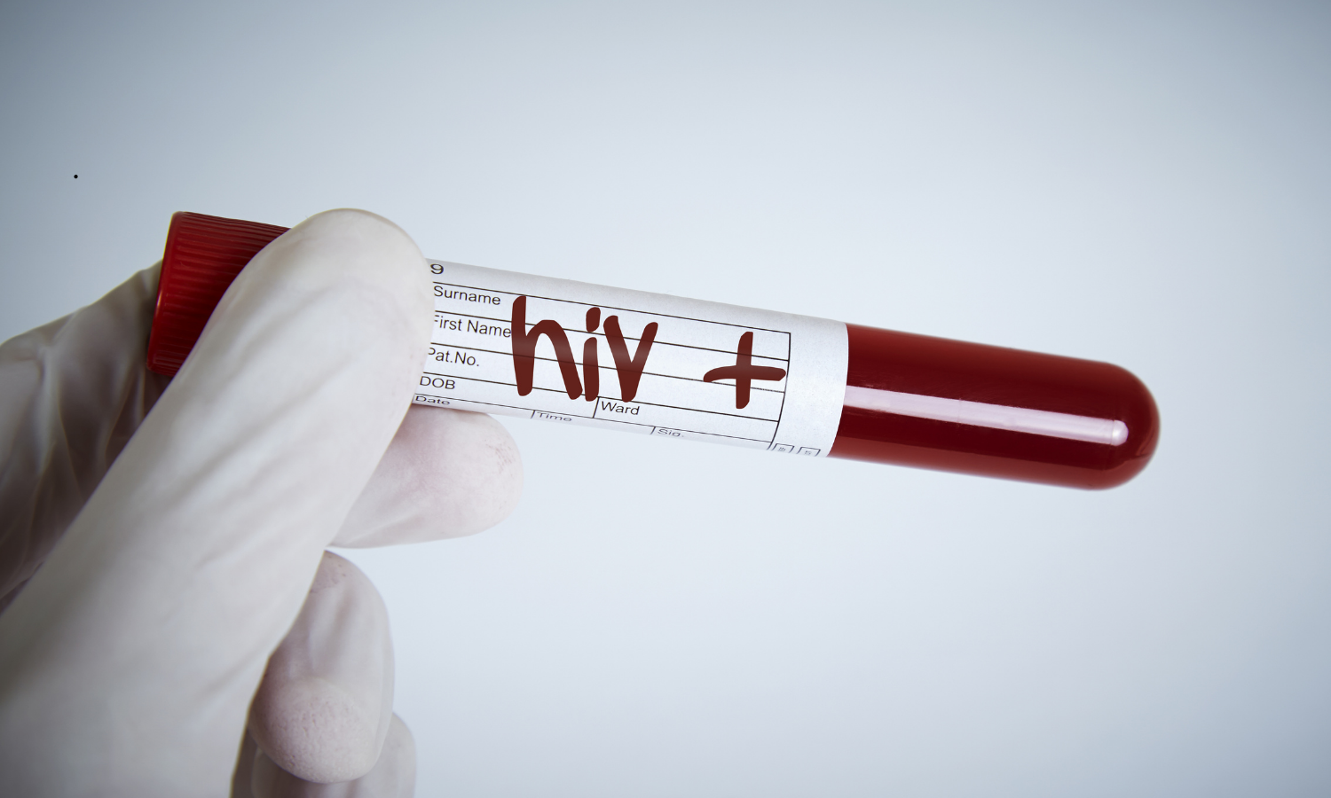 MMS HIV Infections on Rise in Karnataka, 417 New Cases Reported