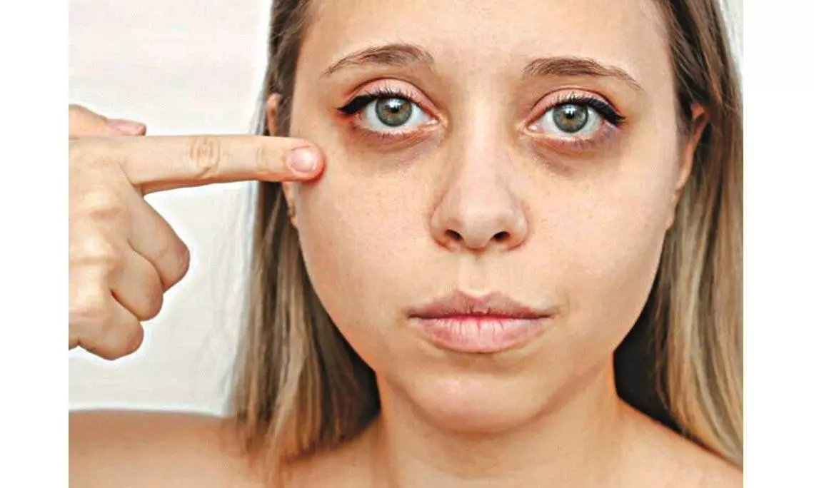 Youngsters Tear T(h)rough Fillers Without a Blink Youngsters Tear T(h)rough Fillers Without a Blink