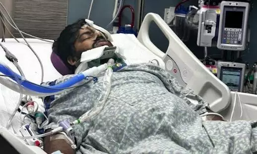 Hyderabad Student Critically Injured in US Car Crash; Battles for Life in ICU Hyderabad Student Critically Injured in US Car Crash; Battles for Life in ICU