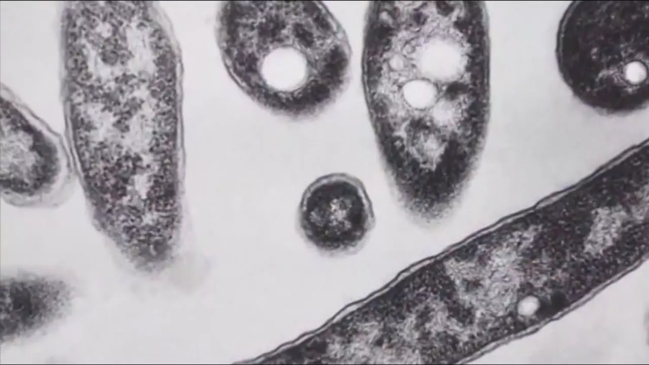 Legionnaires’ Disease Making People Sick On New York’s Upper East Side Legionnaires’ Disease Making People Sick On New York’s Upper East Side