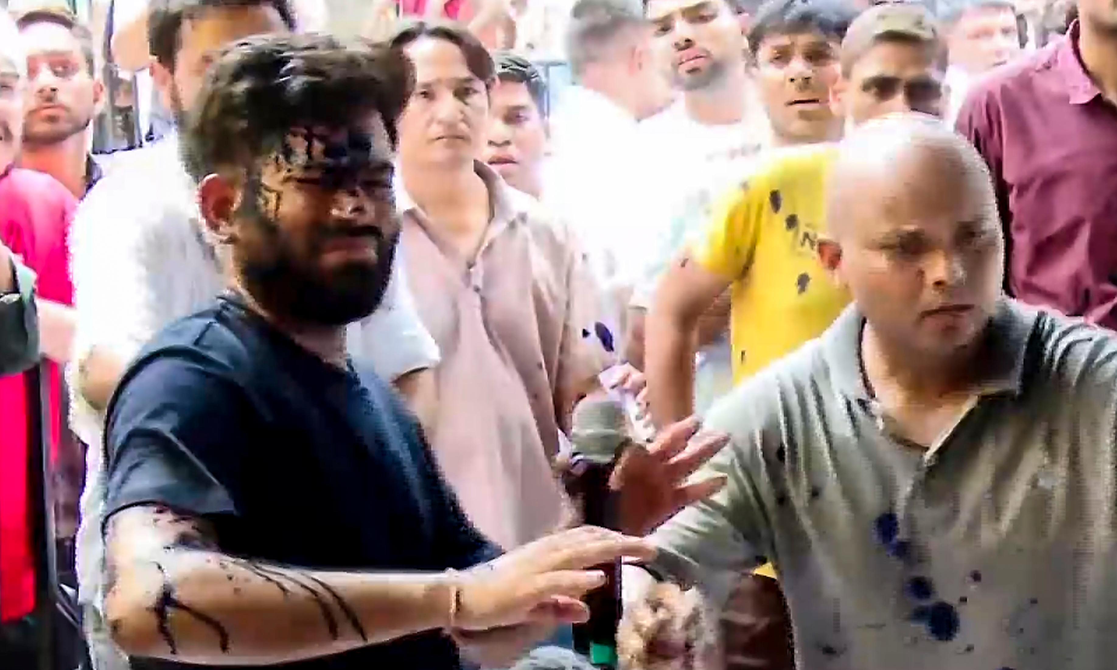 Woman Throws Ink-Like Liquid at Abhijeet Dipke at Jantar Mantar Protest