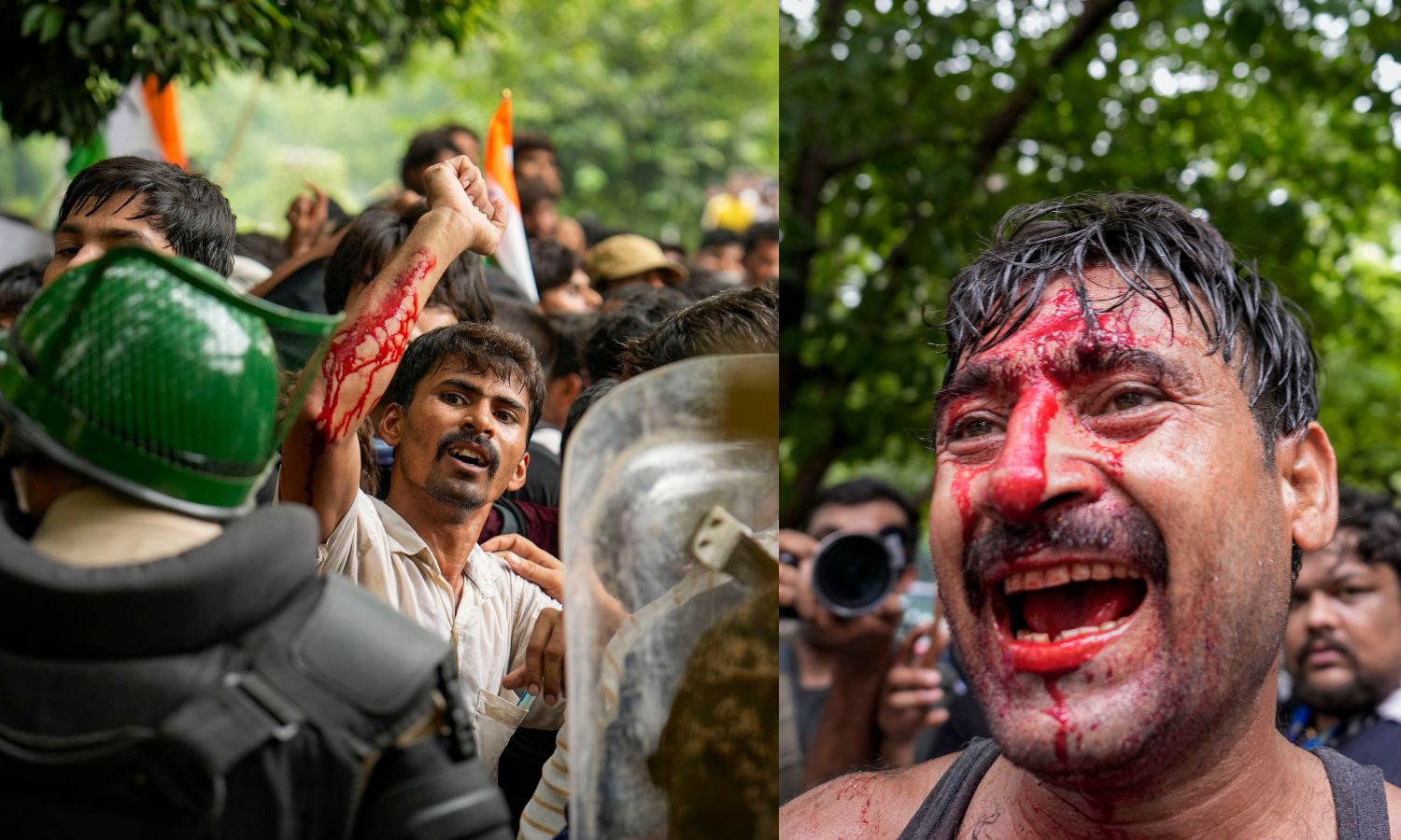 CJP Chalo Sansad: 118 Cops, 60 Protesters Hurt In Clashes
