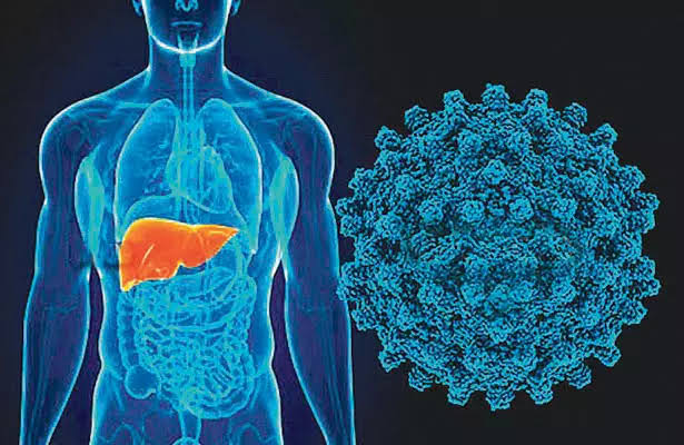 Doctors Urge Early Hepatitis Diagnosis