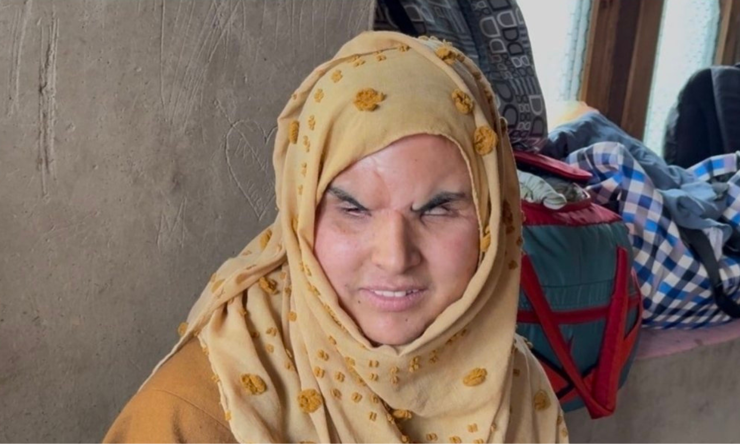 J&K Govt Clears Rs 41 Lakh Aid for 2016 Pellet Victim’s LPG Deal: Minister