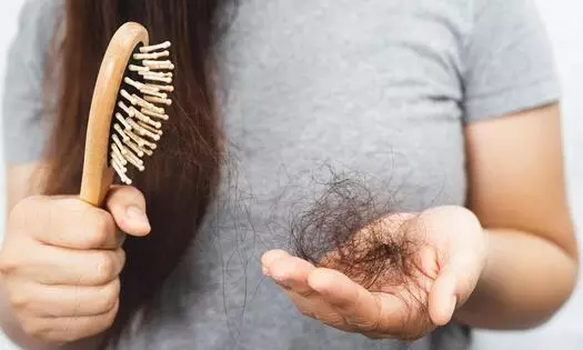 From Ozempic Face to Ozempic Hair: Experts Flag New Hair Loss Concerns From Ozempic Face to Ozempic Hair: Experts Flag New Hair Loss Concerns