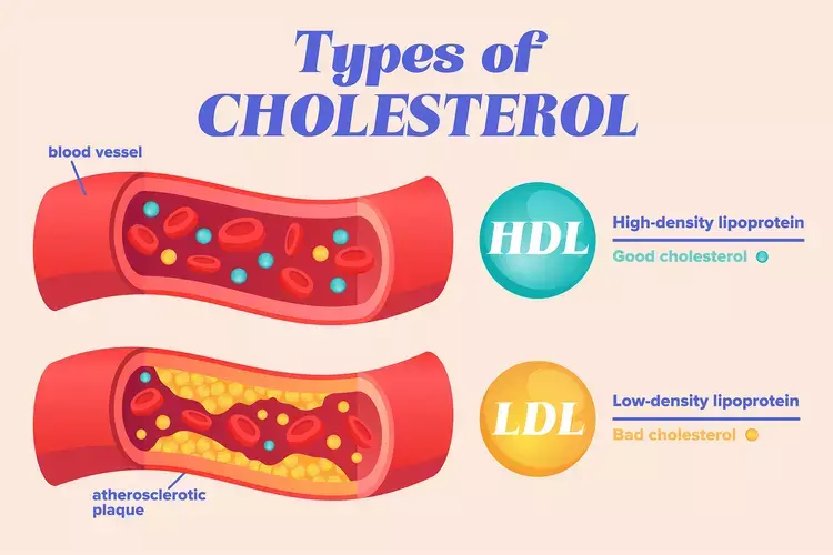 When And How Lipid Levels Can Transform Into A National Anxiety When And How Lipid Levels Can Transform Into A National Anxiety