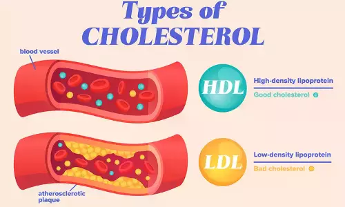 When And How Lipid Levels Can Transform Into A National Anxiety