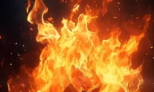 Two Women Attack Sanitation Worker, Set Her Ablaze in Adoni
