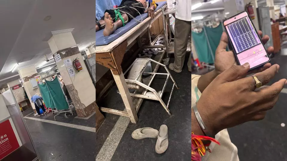 ECG Paper Shortage Hits Gandhi Hospital Services ECG Paper Shortage Hits Gandhi Hospital Services