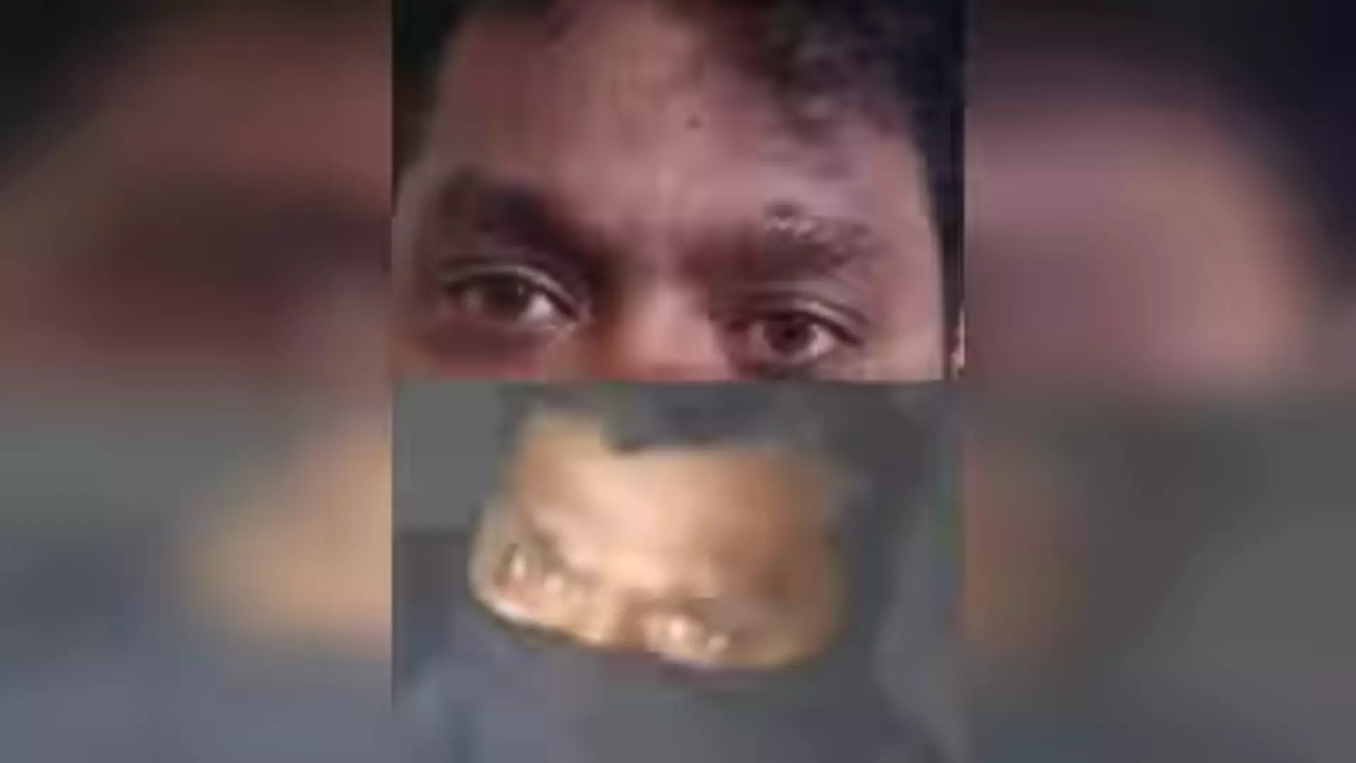 Scar Gives Away Burglar, Held in 48 Hours Scar Gives Away Burglar, Held in 48 Hours