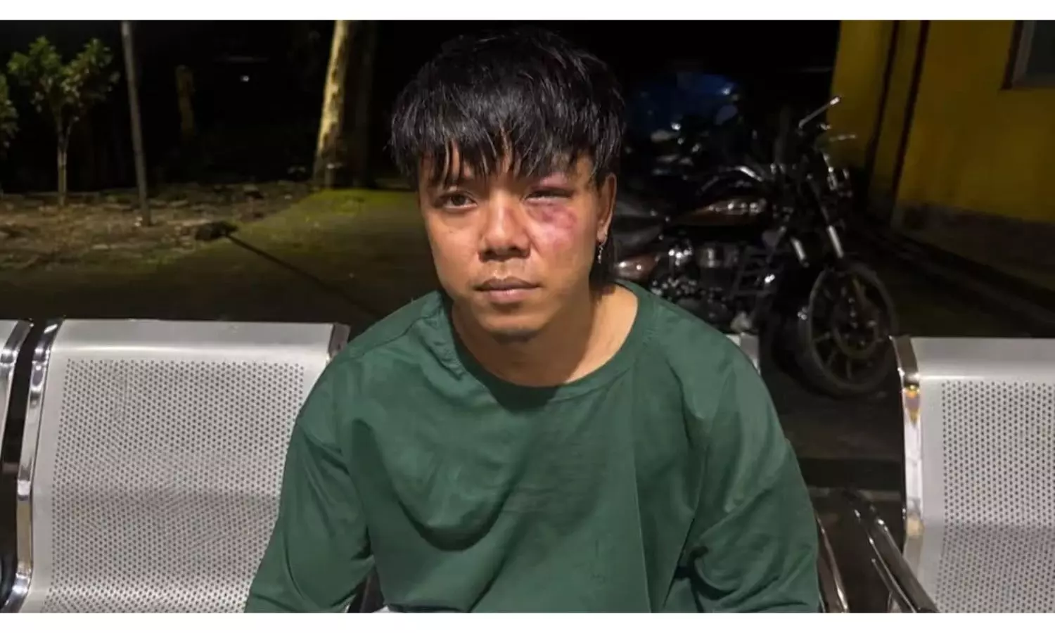 Sikkimese Rapper UNB Attacked In Arunachal While Returning From Concert Sikkimese Rapper UNB Attacked In Arunachal While Returning From Concert