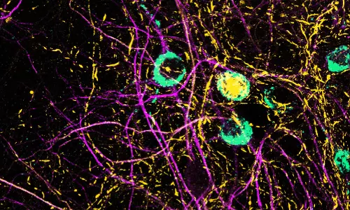 Viral RNA May Trigger Molecular Changes Linked to Parkinson’s, Hyderabad Study Finds