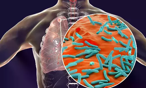 Media Urged To Strengthen Role In TB Elimination