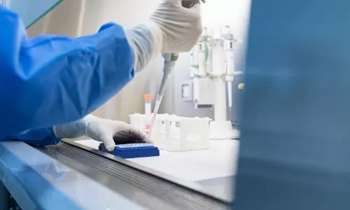 Russia Plague Scare: Researcher Dies, Hundreds Quarantined