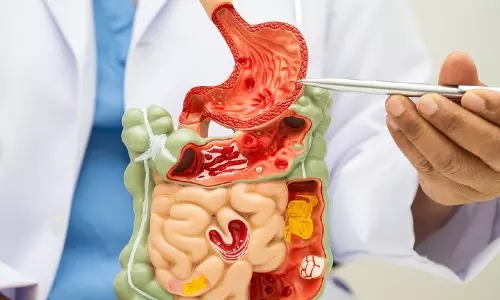 Delhi Sees GI Cancer Patients As Young As 15; Experts Flag Pollution Link